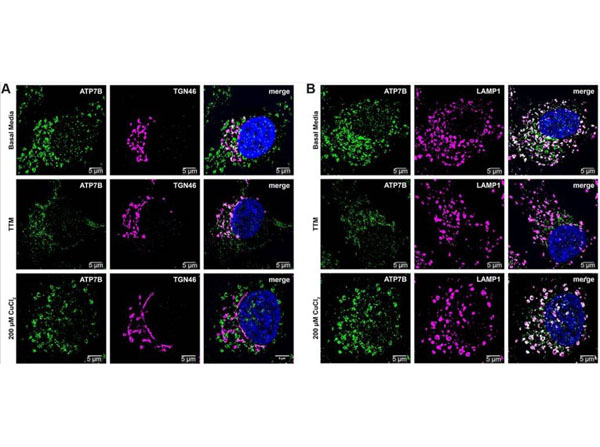 Immunofluorescence using Transferin Rhodamine